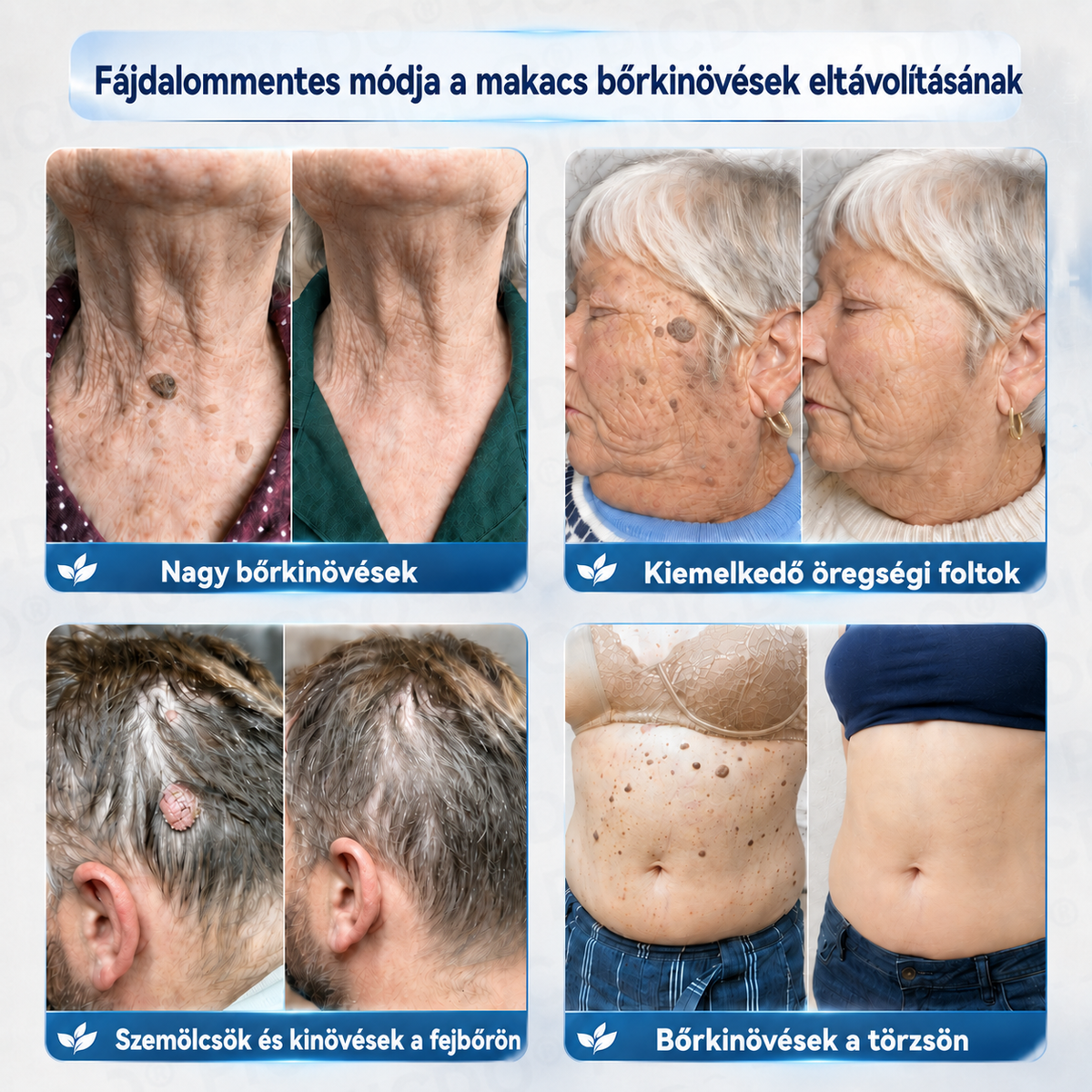 𝐏𝐢𝐜𝐝𝐨® 𝟕 𝐍𝐚𝐩𝐨𝐬 𝐊𝐫é𝐦 𝐁ő𝐫𝐟ü𝐠𝐠𝐞𝐥é𝐤𝐞𝐤 é𝐬 𝐏𝐢𝐠𝐦𝐞𝐧𝐭𝐟𝐨𝐥𝐭𝐨𝐤 𝐄𝐥𝐥𝐞𝐧 (𝐅á𝐣𝐝𝐚𝐥𝐨𝐦𝐦𝐞𝐧𝐭𝐞𝐬 𝐅𝐨𝐫𝐦𝐮𝐥𝐚 – 𝐇𝐞𝐠𝐞𝐤 𝐍é𝐥𝐤ü𝐥)💎💎💎💎💎