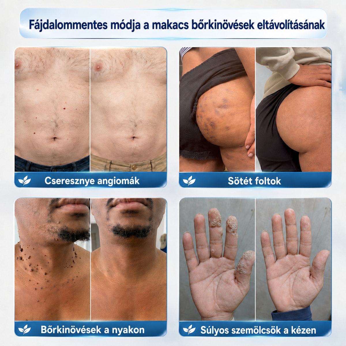 𝐏𝐢𝐜𝐝𝐨® 𝟕 𝐍𝐚𝐩𝐨𝐬 𝐊𝐫é𝐦 𝐁ő𝐫𝐟ü𝐠𝐠𝐞𝐥é𝐤𝐞𝐤 é𝐬 𝐏𝐢𝐠𝐦𝐞𝐧𝐭𝐟𝐨𝐥𝐭𝐨𝐤 𝐄𝐥𝐥𝐞𝐧 (𝐅á𝐣𝐝𝐚𝐥𝐨𝐦𝐦𝐞𝐧𝐭𝐞𝐬 𝐅𝐨𝐫𝐦𝐮𝐥𝐚 – 𝐇𝐞𝐠𝐞𝐤 𝐍é𝐥𝐤ü𝐥)💎💎💎💎💎