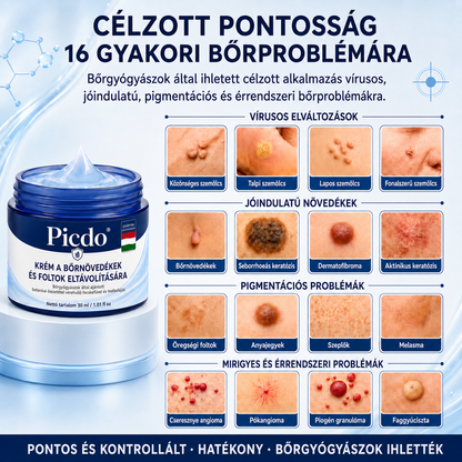𝐏𝐢𝐜𝐝𝐨® 𝟕 𝐍𝐚𝐩𝐨𝐬 𝐊𝐫é𝐦 𝐁ő𝐫𝐟ü𝐠𝐠𝐞𝐥é𝐤𝐞𝐤 é𝐬 𝐏𝐢𝐠𝐦𝐞𝐧𝐭𝐟𝐨𝐥𝐭𝐨𝐤 𝐄𝐥𝐥𝐞𝐧 (𝐅á𝐣𝐝𝐚𝐥𝐨𝐦𝐦𝐞𝐧𝐭𝐞𝐬 𝐅𝐨𝐫𝐦𝐮𝐥𝐚 – 𝐇𝐞𝐠𝐞𝐤 𝐍é𝐥𝐤ü𝐥)💎💎💎💎💎