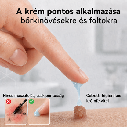 𝐏𝐢𝐜𝐝𝐨® 𝟕 𝐍𝐚𝐩𝐨𝐬 𝐊𝐫é𝐦 𝐁ő𝐫𝐟ü𝐠𝐠𝐞𝐥é𝐤𝐞𝐤 é𝐬 𝐏𝐢𝐠𝐦𝐞𝐧𝐭𝐟𝐨𝐥𝐭𝐨𝐤 𝐄𝐥𝐥𝐞𝐧 (𝐅á𝐣𝐝𝐚𝐥𝐨𝐦𝐦𝐞𝐧𝐭𝐞𝐬 𝐅𝐨𝐫𝐦𝐮𝐥𝐚 – 𝐇𝐞𝐠𝐞𝐤 𝐍é𝐥𝐤ü𝐥)💎💎💎💎💎