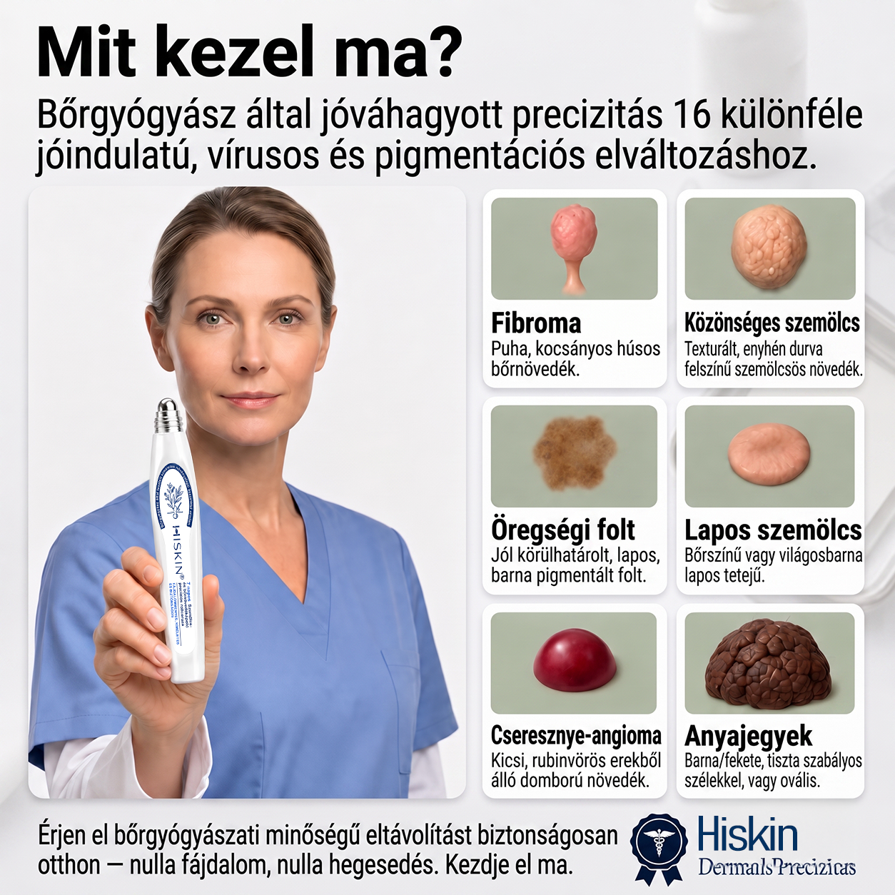 🌟Hivatalos Márkabolt | 🚢🚢 Hiskin® 7 napos Szemölcseltávolító Roll-on Ápoló Folyadék (Fájdalommentes rollerball technológia, hegek nélkül) 🐬