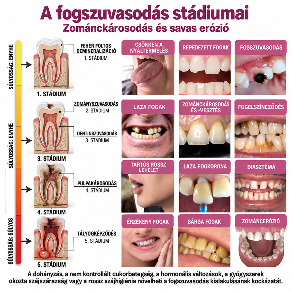 ⭐👨‍⚕️🦷HEATWOLF® DenPerm – Természetes fogzománc-töltő gél a fogszuvasodás helyreállítására🐟🐟