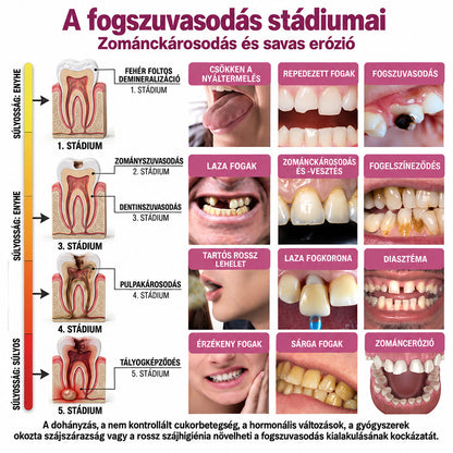 ⭐👨‍⚕️🦷HEATWOLF® DenPerm – Természetes fogzománc-töltő gél a fogszuvasodás helyreállítására🐟🐟