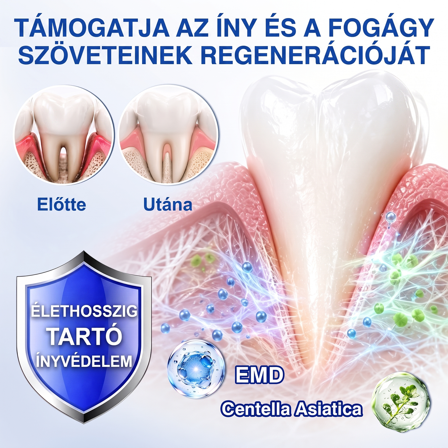匈牙利牙齿🇭🇺🏅🦷🛡️ Dr.Era® GumRevive Parodontális Regeneráló Gél 💎（副本）