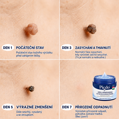 𝐏𝐢𝐜𝐝𝐨® 𝟕 𝐍𝐚𝐩𝐨𝐬 𝐊𝐫é𝐦 𝐁ő𝐫𝐟ü𝐠𝐠𝐞𝐥é𝐤𝐞𝐤 é𝐬 𝐏𝐢𝐠𝐦𝐞𝐧𝐭𝐟𝐨𝐥𝐭𝐨𝐤 𝐄𝐥𝐥𝐞𝐧 (𝐅á𝐣𝐝𝐚𝐥𝐨𝐦𝐦𝐞𝐧𝐭𝐞𝐬 𝐅𝐨𝐫𝐦𝐮𝐥𝐚 – 𝐇𝐞𝐠𝐞𝐤 𝐍é𝐥𝐤ü𝐥)💎💎💎💎💎