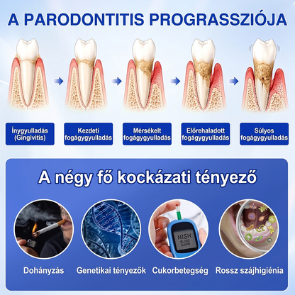 匈牙利牙齿🇭🇺🏅🦷🛡️ Dr.Era® GumRevive Parodontális Regeneráló Gél 💎（副本）