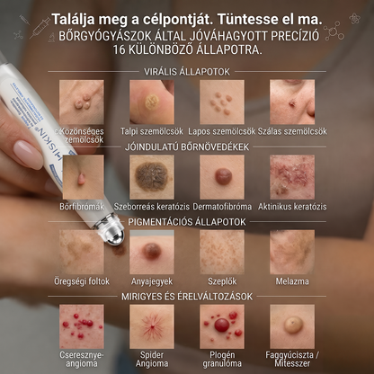 🌟Hivatalos Márkabolt | 🚢🚢 Hiskin® 7 napos Szemölcseltávolító Roll-on Ápoló Folyadék (Fájdalommentes rollerball technológia, hegek nélkül) 🐬