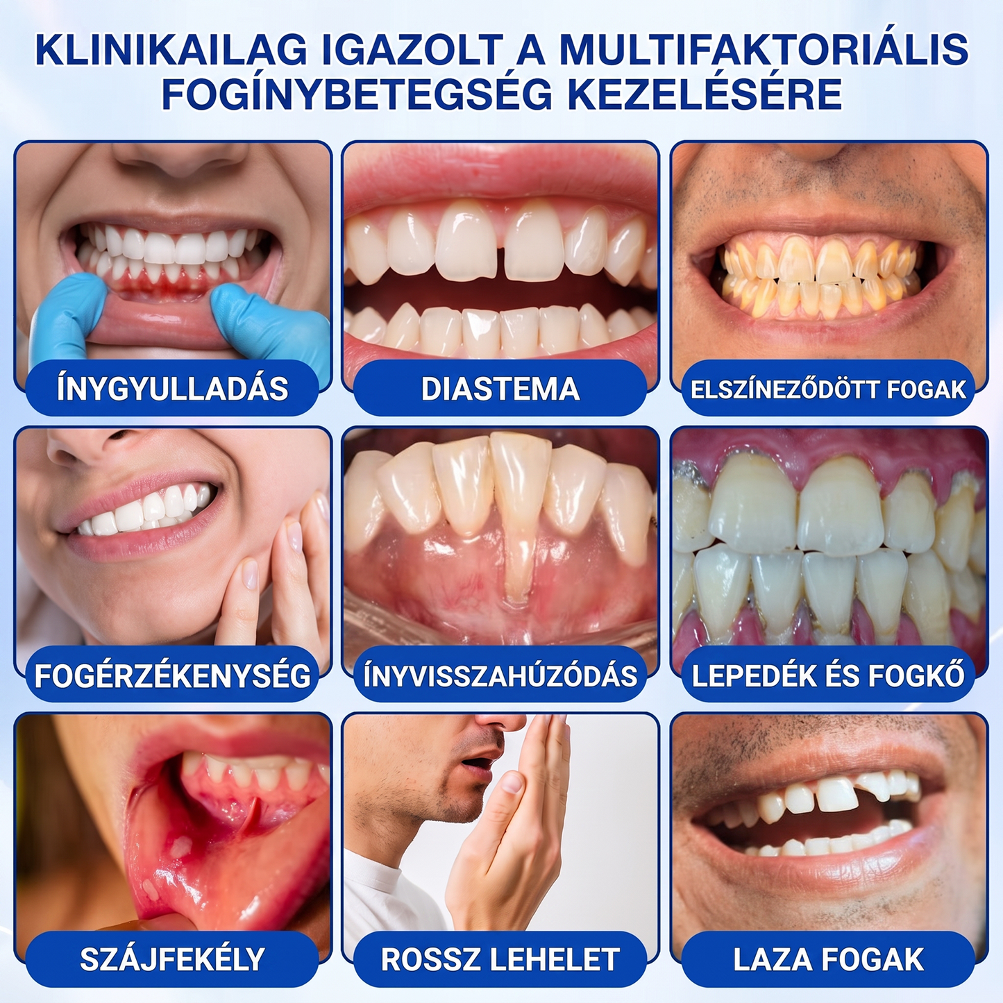 匈牙利牙齿🇭🇺🏅🦷🛡️ Dr.Era® GumRevive Parodontális Regeneráló Gél 💎（副本）
