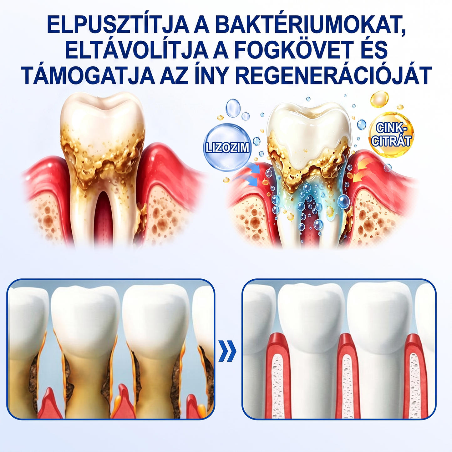 匈牙利牙齿🇭🇺🏅🦷🛡️ Dr.Era® GumRevive Parodontális Regeneráló Gél 💎（副本）