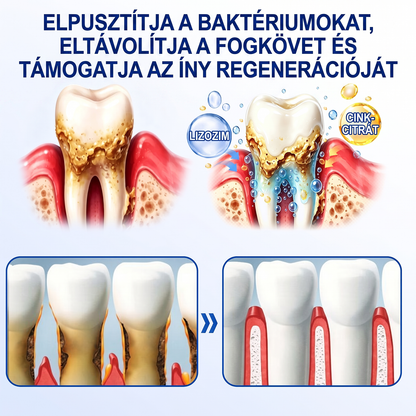 匈牙利牙齿🇭🇺🏅🦷🛡️ Dr.Era® GumRevive Parodontális Regeneráló Gél 💎（副本）