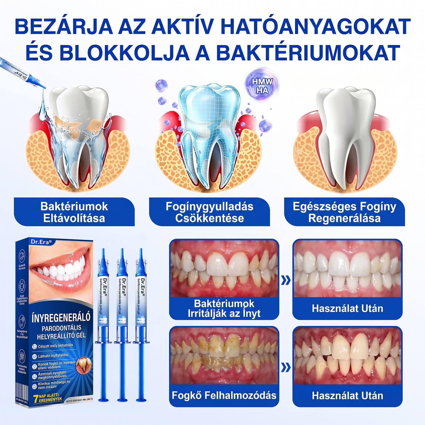 匈牙利牙齿🇭🇺🏅🦷🛡️ Dr.Era® GumRevive Parodontális Regeneráló Gél 💎（副本）
