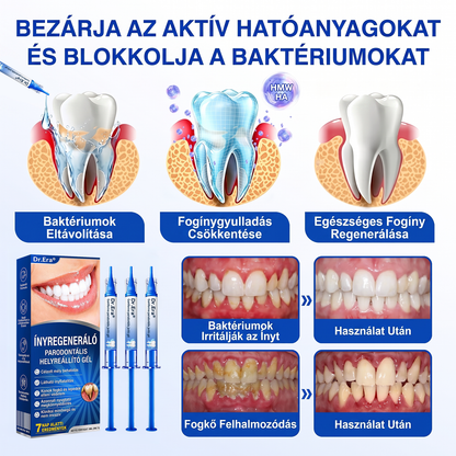 匈牙利牙齿🇭🇺🏅🦷🛡️ Dr.Era® GumRevive Parodontális Regeneráló Gél 💎（副本）